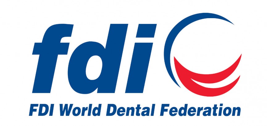 FDI